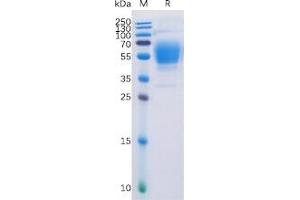 Human CB1 Protein, hFc Tag on SDS-PAGE under reducing condition.
