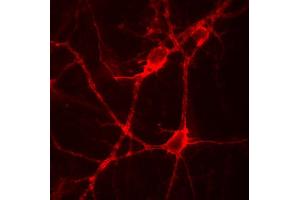 Indirect immunolabeling of PFA fixed rat hippocampus neurons.