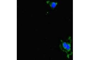 Immunofluorescent analysis of Hela cells using ABIN7143664 at dilution of 1:100 and Alexa Fluor 488-congugated AffiniPure Goat Anti-Rabbit IgG(H+L) (ALDH16A1 anticorps  (AA 1-220))