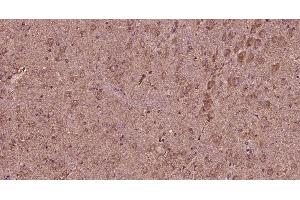 Paraformaldehyde-fixed, paraffin embedded rat brain, Antigen retrieval by boiling in sodium citrate buffer (pH6) for 15min, Block endogenous peroxidase by 3% hydrogen peroxide for 30 minutes, Blocking buffer (normal goat serum) at 37°C for 20min, Antibody incubation with Progestin Receptor Beta/MPRB Antibody at 1:400 overnight at 4°C, followed by a conjugated secondary and DAB staining. (Progestin Receptor beta/mprb (AA 251-300) anticorps)