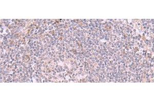 Immunohistochemistry of paraffin-embedded Human tonsil tissue using INPP5K Polyclonal Antibody at dilution of 1:90(x200) (INPP5K anticorps)