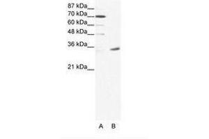 Image no. 1 for anti-Melanoma Antigen Family A, 9 (MAGEA9) (N-Term) antibody (ABIN202005) (MAGEA9 anticorps  (N-Term))