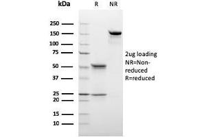 SDS-PAGE Analysis Purified C1QB Mouse Monoclonal Antibody (C1QB/2966).
