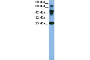 WB Suggested Anti-CDK2 Antibody Titration:  1 ug/ml  Positive Control:  Jurkat cell lysate CDK2 is strongly supported by BioGPS gene expression data to be expressed in Human Jurkat cells (CDK2 anticorps  (C-Term))