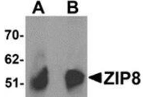 Western blot analysis of ZIP8 in human spleen tissue lysate with ZIP8 antibody at (A) 1 and (B) 2 μg/ml. (SLC39A8 anticorps  (C-Term))