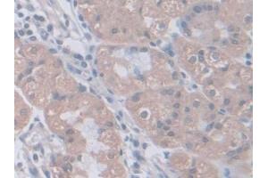 Detection of PGM1 in Human Stomach Tissue using Polyclonal Antibody to Phosphoglucomutase 1 (PGM1)