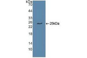 Detection of Recombinant UBE2C, Human using Polyclonal Antibody to Ubiquitin Conjugating Enzyme E2C (UBE2C) (UBE2C anticorps  (AA 2-179))