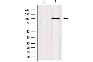 Western blot analysis of extracts from Myeloma cells, using Drebrin Antibody. (DBN1 anticorps  (Internal Region))