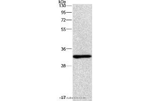 Western blot analysis of mouse kindey tissue, using NAPSA Polyclonal Antibody at dilution of 1:500