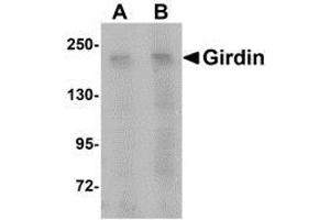 Western blot analysis of Girdin in rat brain tissue lysate with AP30364PU-N Girdin antibody at (A) 1 and (B) 2 μg/ml. (Girdin anticorps  (C-Term))