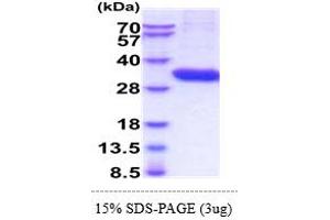 SDS-PAGE (SDS) image for Tryptase alpha/beta 1 (TPSAB1) (AA 31-275) protein (His tag) (ABIN5855023)