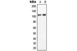 Western blot analysis of NGEP expression in MCF7 (A), NIH3T3 (B) whole cell lysates. (Anoctamin 7 anticorps  (C-Term))