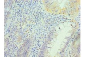 Immunohistochemistry of paraffin-embedded human epityphlon tissue using ABIN7162944 at dilution of 1:100 (Peroxiredoxin 5 anticorps  (AA 53-214))