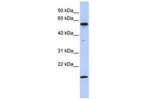 Image no. 1 for anti-Thyroid Hormone Receptor Interactor 10 (TRIP10) (C-Term) antibody (ABIN6742770) (TRIP10 anticorps  (C-Term))