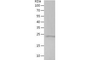 Western Blotting (WB) image for Mediator Complex Subunit 28 (MED28) (AA 1-178) protein (His tag) (ABIN7123873)