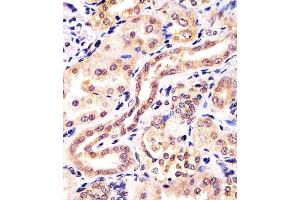 Antibody staining KCTD11 in human kidney tissue sections by Immunohistochemistry (IHC-P - paraformaldehyde-fixed, paraffin-embedded sections). (KCTD11 anticorps  (AA 21-53))