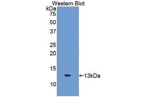 Western Blotting (WB) image for anti-Interleukin 6 Receptor (IL6R) (AA 385-462) antibody (ABIN3206018) (IL-6 Receptor anticorps  (AA 385-462))