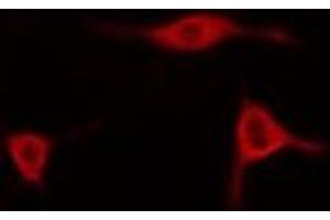 ABIN6278550 staining Hela cells by IF/ICC. (AIFM2 anticorps  (Internal Region))