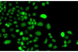 Immunofluorescence analysis of A549 cells using PIP4K2A Polyclonal Antibody