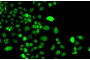 Immunofluorescence analysis of A549 cells using PIP4K2A Polyclonal Antibody (PIP4K2A anticorps)