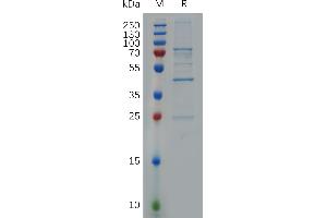 Human B10 Protein, N-S Tag on SDS-PAGE under reducing condition.