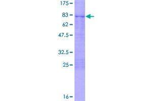 Image no. 1 for Chromobox Homolog 8 (CBX8) (AA 1-389) protein (GST tag) (ABIN1348218)