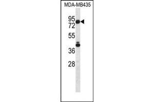 Western blot analysis using SGPL1 Antibody (N-term) Cat.
