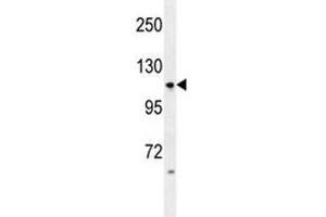 Anti-LGR5 antibody western blot analysis in HL-60 lysate