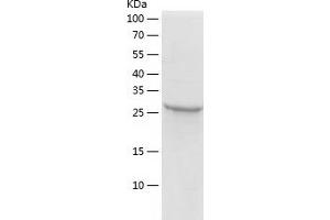Western Blotting (WB) image for Hydroxyprostaglandin Dehydrogenase 15-(NAD) (HPGD) (AA 1-266) protein (His-IF2DI Tag) (ABIN7123382)