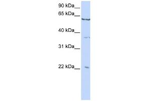 WB Suggested Anti-CSRP2 Antibody Titration:  0. (CSRP2 anticorps  (C-Term))