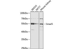 Western blot analysis of extracts of various cell lines, using Smad5 antibody (ABIN6128714, ABIN6148090, ABIN6148091 and ABIN6218232) at 1:1000 dilution. (SMAD5 anticorps  (AA 186-465))