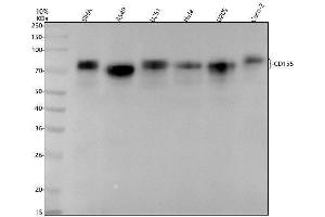 Western blot analysis of CD155/PVR using anti-CD155/PVR antibody (ABIN7606009).