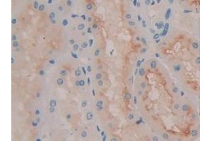Detection of QSOX1 in Human Kidney Tissue using Polyclonal Antibody to Quiescin Q6 Sulfhydryl Oxidase 1 (QSOX1)