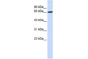 ADAM9 antibody used at 1 ug/ml to detect target protein.