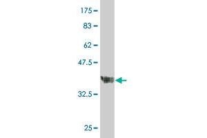 Western Blot detection against Immunogen (37.