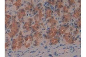 Detection of IFNg in Rat Stomach Tissue using Polyclonal Antibody to Interferon Gamma (IFNg)