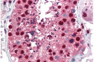 Human Testis (formalin-fixed, paraffin-embedded) stained with PAX7 antibody ABIN462176 followed by biotinylated goat anti-rabbit IgG secondary antibody ABIN481713, alkaline phosphatase-streptavidin and chromogen.