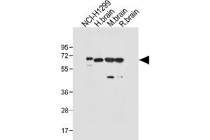 All lanes : Anti-DLL3 Antibody (C-term) at 1:1000 dilution Lane 1: NCI- whole cell lysate Lane 2: Human brain tissue lysate Lane 3: Mouse brain tissue lysate Lane 4: Rat brain whole cell lysate Lysates/proteins at 20 μg per lane.
