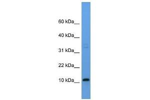 Western Blot showing Cyyr1 antibody used at a concentration of 1-2 ug/ml to detect its target protein. (CYYR1 anticorps  (Middle Region))