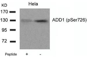 Western blot analysis of extracts from Hela cells using ADD1(Phospho-Ser726) Antibody and the same antibody preincubated with blocking peptide.