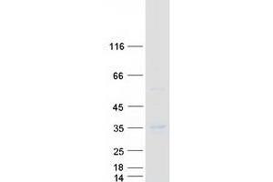 Validation with Western Blot