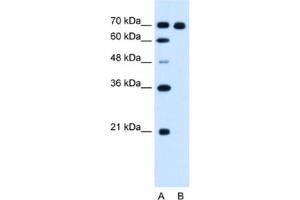 Western Blotting (WB) image for anti-Ribonucleotide Reductase M1 (RRM1) antibody (ABIN2462919) (RRM1 anticorps)