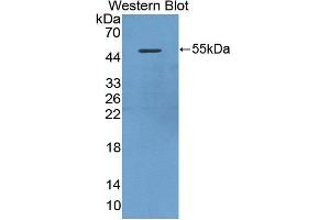 Figure. (DAPK3 anticorps  (AA 1-448))