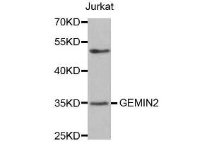 Western blot analysis of extracts of Jurkat cells, using GEMIN2 antibody. (SIP1 anticorps)