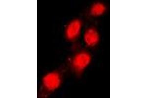Immunofluorescent analysis of TEAD1 staining in Raw264.