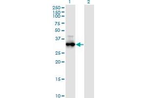 Western Blot analysis of PRKG1 expression in transfected 293T cell line by PRKG1 monoclonal antibody (M01), clone 5E5.