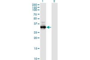 Western Blot analysis of PRKG1 expression in transfected 293T cell line by PRKG1 monoclonal antibody (M01), clone 5E5. (PRKG1 anticorps  (AA 73-170))