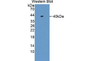Western blot analysis of the recombinant protein. (HNRNPA1 anticorps  (AA 2-320))