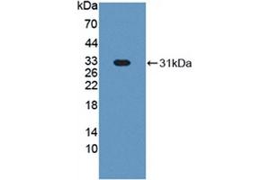 Western blot analysis of recombinant Cow HABP1. (C1QBP anticorps  (AA 71-278))