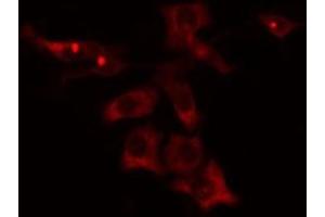 ABIN6275808 staining Hela cells by IF/ICC. (CYP4V2 anticorps  (Internal Region))